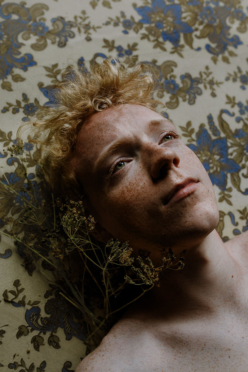 Freckled