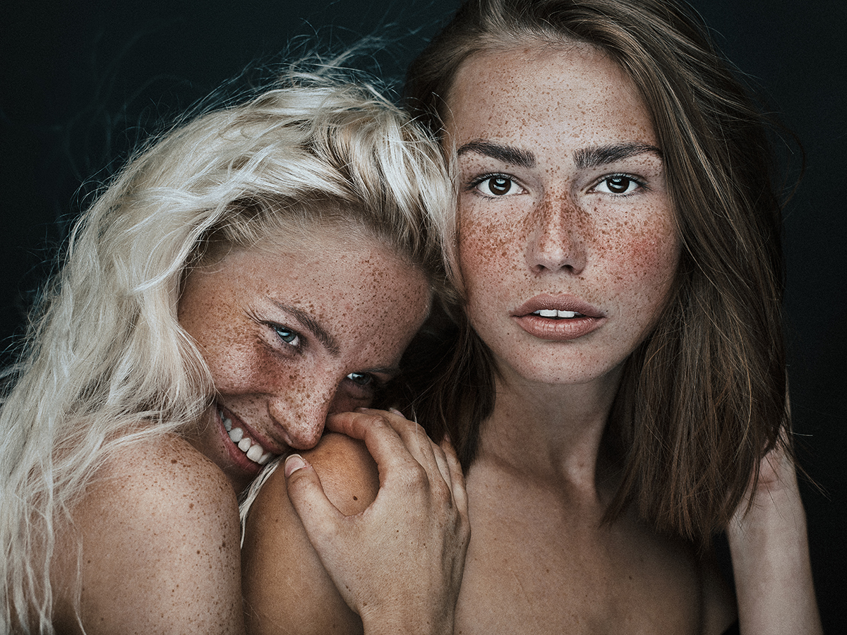 Freckles beauty