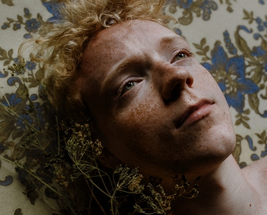 Freckled 